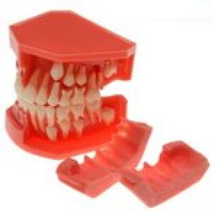 歯列模型 上下顎 歯の発達模型 乳歯&永久歯 4636